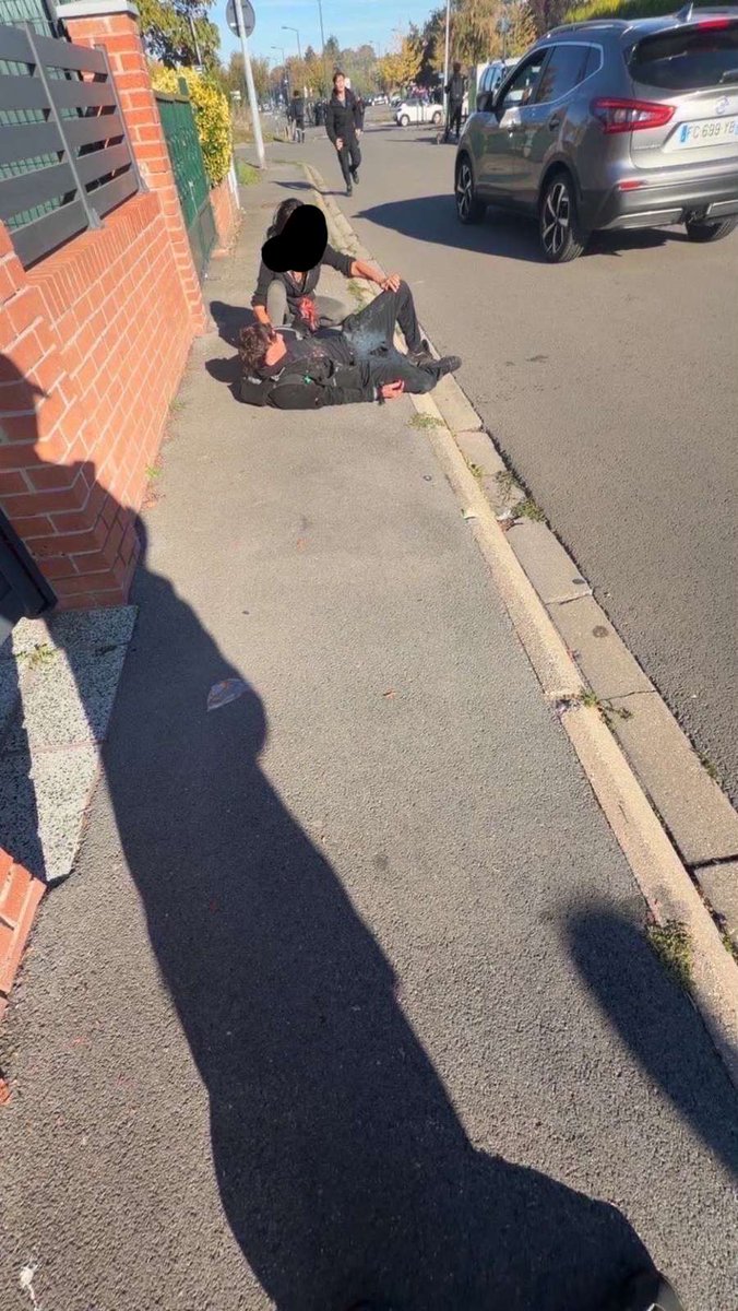 mchtpas's tweet photo. Un lycéen s'est fait coupé la main par un tir de flashball aujourd'hui au lycée behal à Lens arrêtez jamais de dénoncer ces chiens https://t.co/QY6Znj5OyX