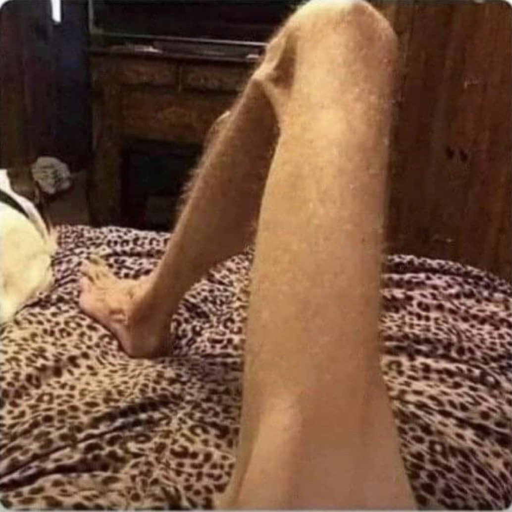 Talikithegreat7's tweet photo. Brown thighs 
Thighs in Uganda.    Vs. Thighs in DRC https://t.co/b5DmvUXsz6