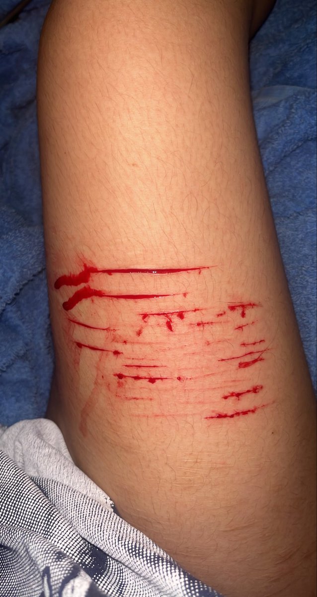 PR0depressant's tweet photo. that’s the longest cut i’ve ever made in my life #itsover #killme https://t.co/dj9XKd4ZBi