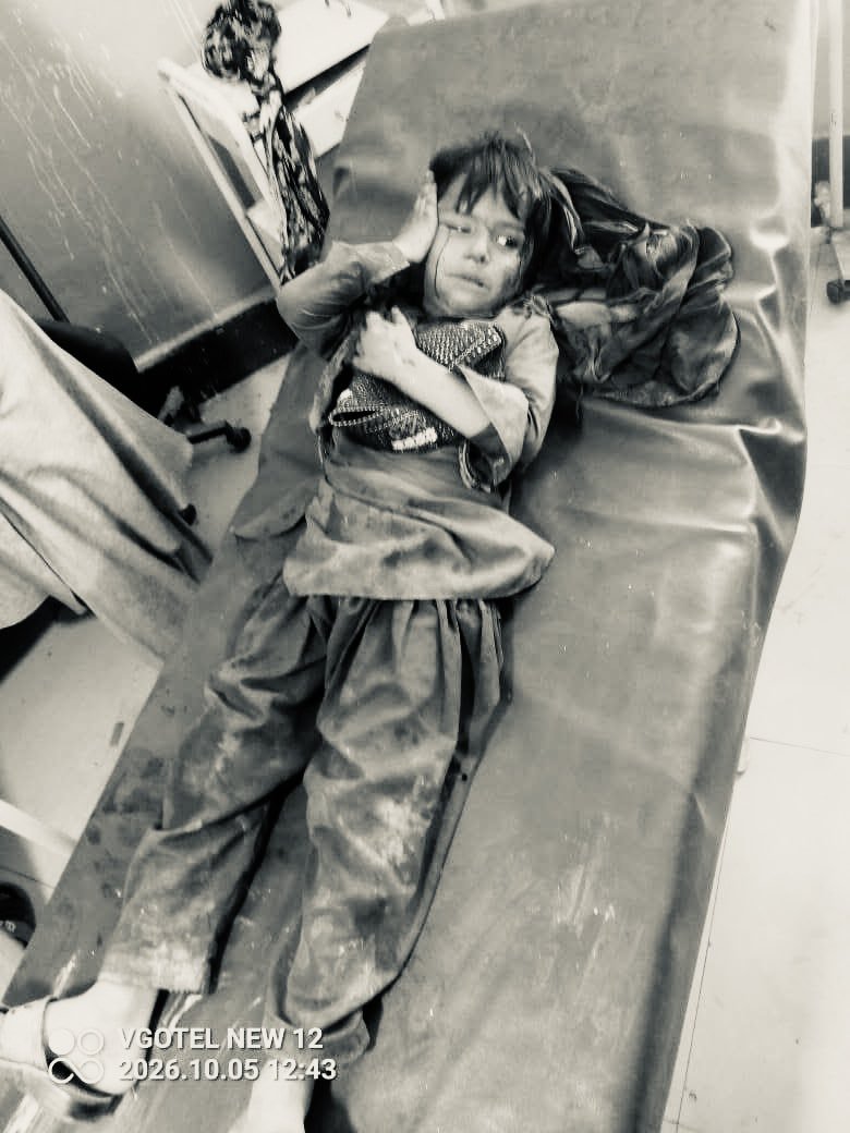 Waziriwuu4's tweet photo. ظالم جابر اور وخشی ریاست  پاکستان نے شمالی وزیرستان کی تحصیل میرعلی کے گاؤں ناونہ میں کواڈ کاپٹر ڈرون سے بم گرا کر نتیجے میں 8 معصوم بچے شدید زخمی ہوئے ہیں۔ زخمی بچوں کو علاج ��ے لیے میرعلی ہسپتال منتقل کر دیا گیا ہے۔
پاکستانی فواج “Small Baby Killer” https://t.co/fXciEJomhl