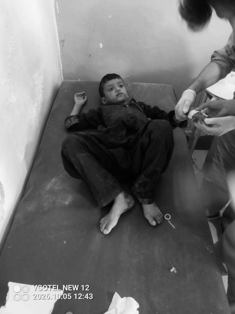 Waziriwuu4's tweet photo. ظالم جابر اور وخشی ریاست  پاکستان نے شمالی وزیرستان کی تحصیل میرعلی کے گاؤں ناونہ میں کواڈ کاپٹر ڈرون سے بم گرا کر نتیجے میں 8 معصوم بچے شدید زخمی ہوئے ہیں۔ زخمی بچوں کو علاج ��ے لیے میرعلی ہسپتال منتقل کر دیا گیا ہے۔
پاکستانی فواج “Small Baby Killer” https://t.co/fXciEJomhl