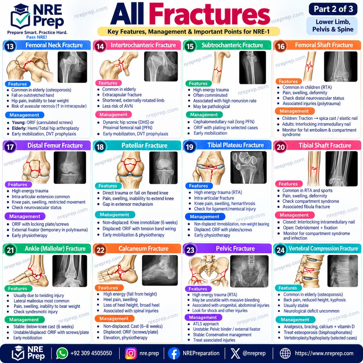 nreprep's tweet photo. 𦴠ALL FRACTURES π
#NRE1 #NRE2026 #NREPrep #NREPreparation #NRE1October2026 #Fractures #Orthopaedics #Orthopedics #OrthopaedicMCQs #MedicalMCQs #MBBS #MedicalStudents #NREExam #HighYield #NRERevision #QuickRevision #SurgeryRevision #Trauma #OrthopedicTrauma #NREPrepCom https://t.co/cAwdTt4Ezn