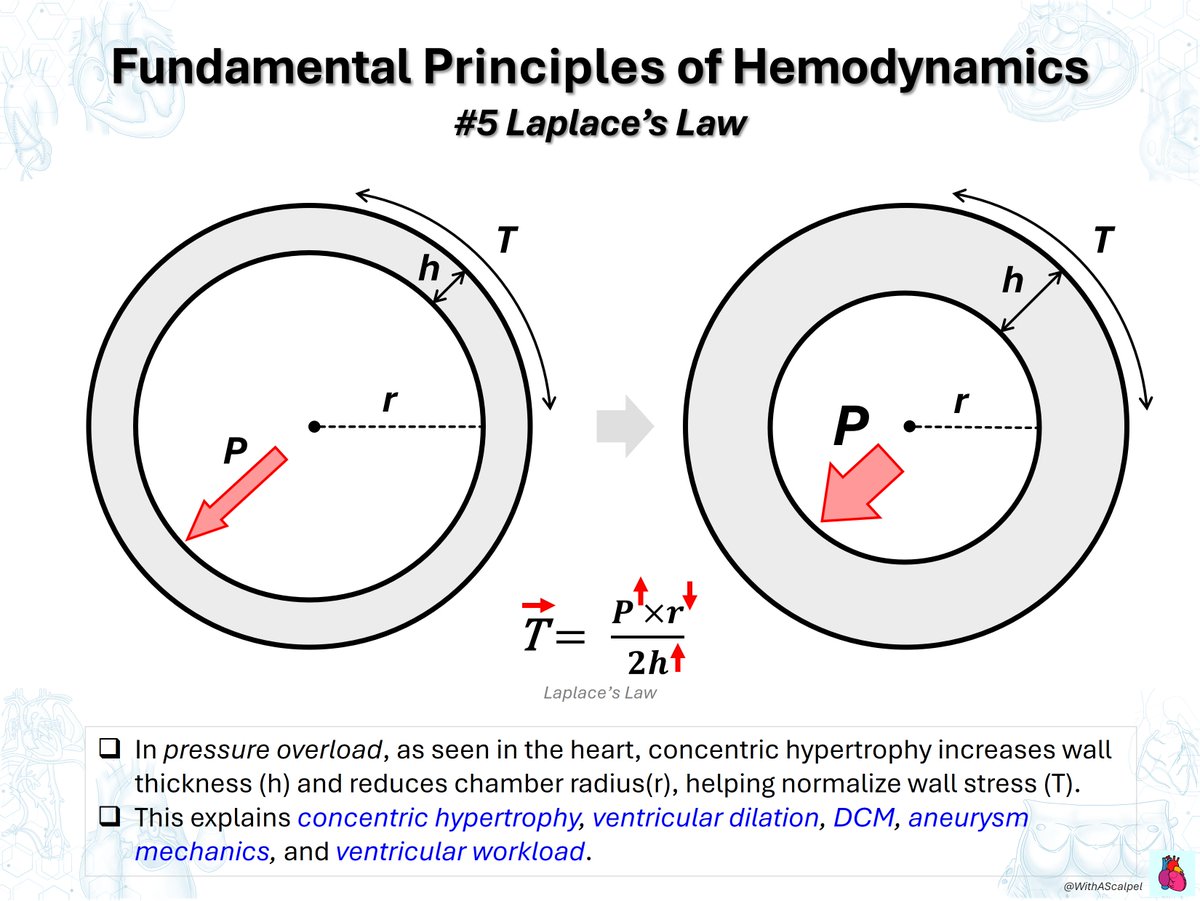 WithAScalpel's tweet photo. Fundamental Principles of Hemodynamics: Ohm’s Law & Laplace’s Law

👉Hemodynamic Ohm’s law defines flow as Q = ΔP/R : pressure gradient drives flow, while vascular resistance opposes it.
👉Laplace’s law relates wall stress as T = (P × r)/(2h) : stress rises with ↑P or ↑r and falls with ↑h.
👉Clinically, these principles frame SVR/PVR, ventricular pressure/volume overload, hypertrophy/dilation, etc