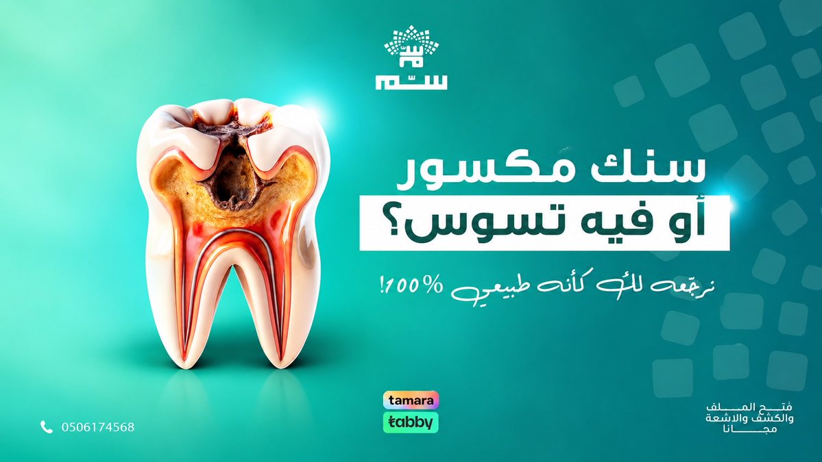 sumclinics's tweet photo. الحشوات التجميلية، بتطابق تام مع لون أسنانك للحفاظ على شكل السن وقوته بدون اي اثر ظاهر
#الرياض #عيادة_سم #المرسلات https://t.co/kggBbVPjI8