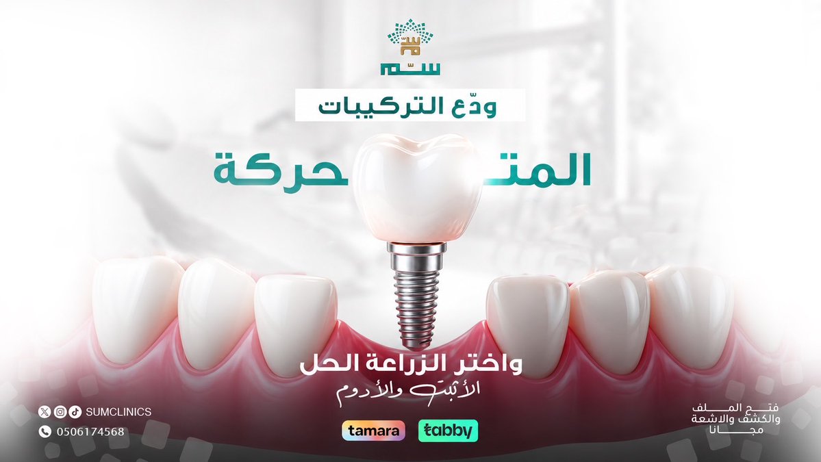 sumclinics's tweet photo. الزراعة هي الخيار الطبي والجمالي الأمثل لتعويض الأسنان المفقودة بشكل دائم ينغمك مع عظم الفك ويحافظ على المظهر الطبيعي لوجهك دون التأثير على الأسنان الجاورة
اطمئن…أطباؤنا يرافقونك بخطة علاجية امنه ومريحة
#اسنان #عيادة_سم #المرسلات #الرياض_الآن https://t.co/QwZ2Ut93sB