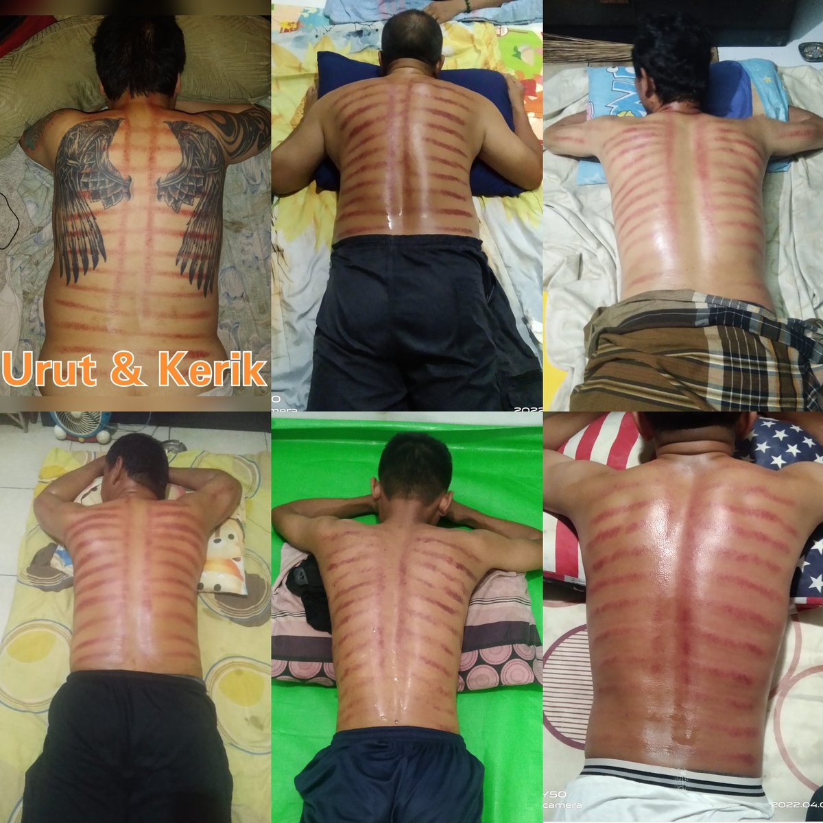Pijatpass6969's tweet photo. Buat yg badannya capek dan pegal² butuh terapis pijat, bisa saya bantu yaa..
Tersedia terapis Pria &amp; Wanita untuk daerah Jakarta &amp; Tangerang..
Terima panggilan ke rumah, kost, apart &amp; hotel.. https://t.co/eOuHfUifRn