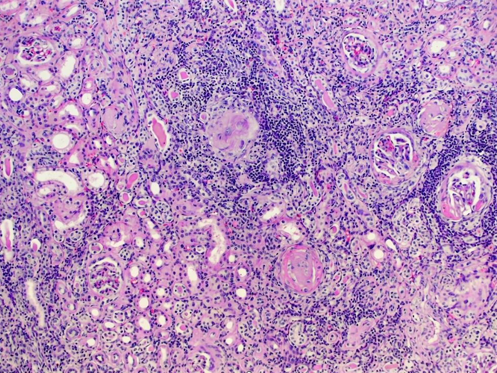pathothama tweet picture