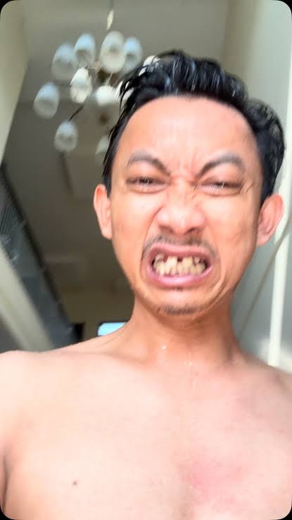 splYONO's tweet photo. @TUKANGxGALON Hlozz,,, knalinzz akzz yonzz dblikzz emotzz 🦷 iyhzz,, zlem knalzz pkoknyzz,, akzz zbgayy editorzz dziny,,,  zlken iyhzz,,, https://t.co/Du1pMmH0yT