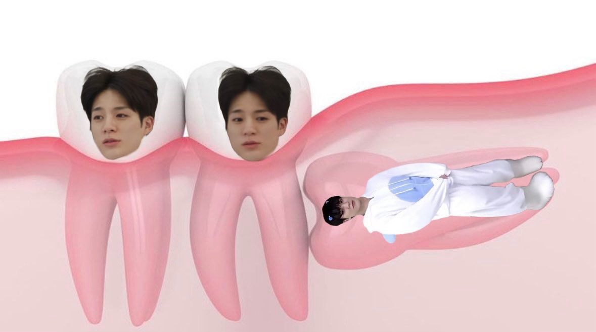 e_jenn0's tweet photo. 사랑니제노 https://t.co/iy1b2kV2aO