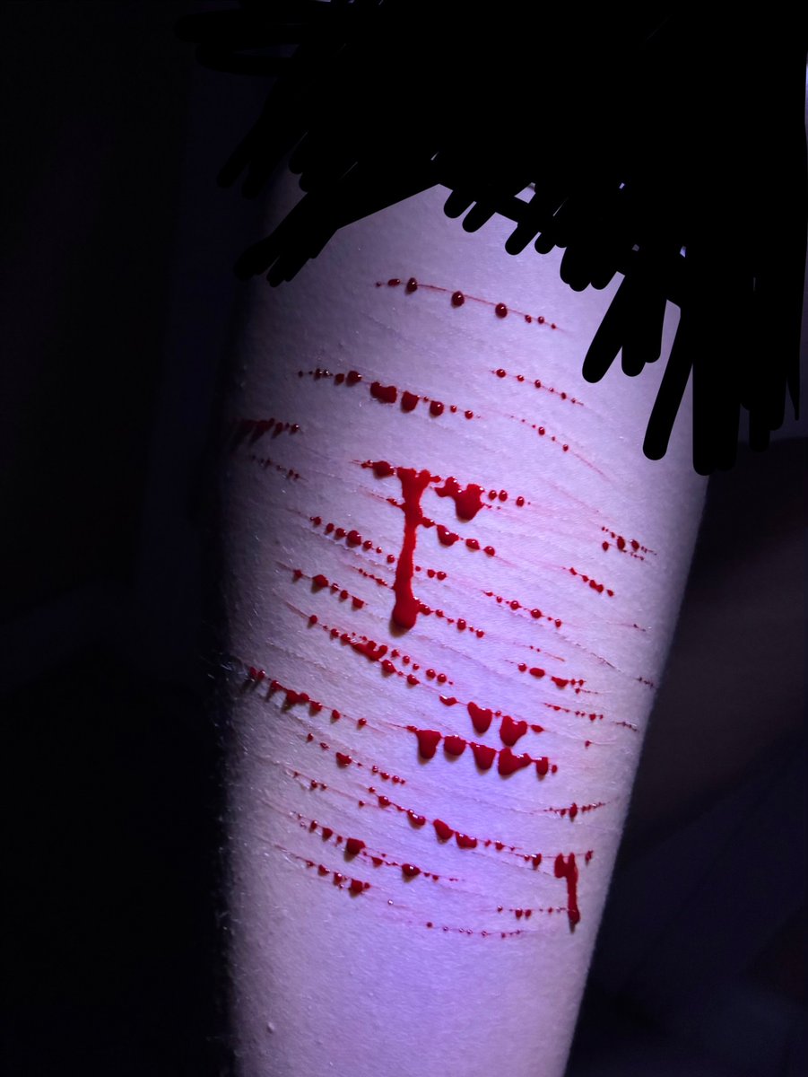 ArtByAPen's tweet photo. Catscratch sesh on thigh last night yay

!!!FAKE SFX MAKEUP FOR HALLOWEEN COSTUME, MADE BY ME! ENHANCED BY AI!!! https://t.co/mIB73D2XpQ