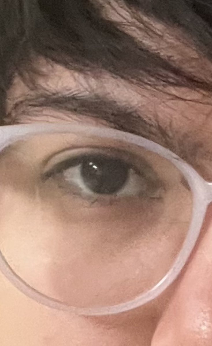smilybelle's tweet photo. Eye reveal (?) cause im bored waiting at the doctor :P
I look kinda angry idk why https://t.co/tJyUTWviL8