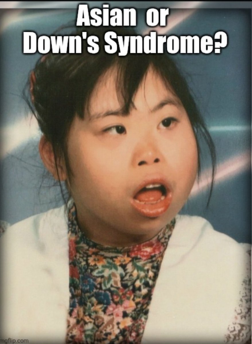 CubeSwirly's tweet photo. @rheafeminine Rather be Black than look like I have downs syndrome . https://t.co/STTIWhKoBD
