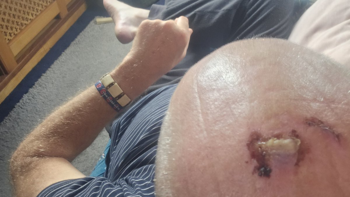 wayneDJC's tweet photo. Healing well and learning again how to duck ! https://t.co/mGdtdz2aVx