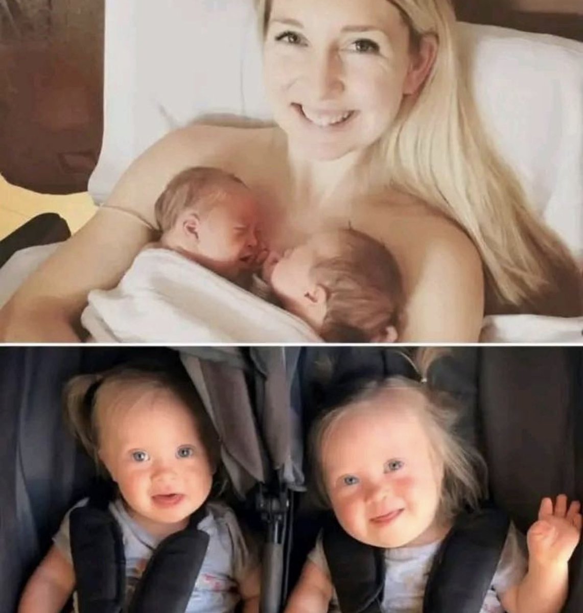 feelgoodtale's tweet photo. When Rachael, 39, was told she was expecting twins with Down syndrome, the doctors’ first reaction wasn’t surprise. It was fear

Not theirs. Hers—expected, anticipated, almost demanded.
They told her six times.

Six times they offered her an abortion.
And even before her daughters were born, someone went so far as to offer condolences.

But Rachael didn’t cry.

She didn’t shake

She didn’t want to run away.

Beside her, her husband Cody—a young student pilot—chose to stay with her.
Despite the fears.

Despite their daughters’ hearts showing serious defects.

Despite everyone’s eyes on those extra chromosomes as if they were a verdict.
Charlotte and Annette were born in 2018.

Identical, small, powerful.
A one-in-a-million case.
Two lives that should have been frightening, yet brought hope instead.
Charlotte underwent heart surgery at six months.

Annette, against all odds, was born without heart defects.

The birth? Natural. No emergencies.
Just immense gratitude.
Around them, silences full of dark expectations.

As if everyone was ready to see them suffer.

But Rachael makes it clear:

“There was no pain in our hearts. Only love. For those living little bodies, for those smiles full of life, for those extra chromosomes that don’t change the essential.”

Today, Charlotte and Annette explore the world with eyes full of wonder.
Small, yes. With unsteady steps and laughter that fills the house.
They play with their siblings, cuddle the dog Max.

They live every day with a joy that can’t be measured by medical charts.
Rachael has no doubts:
“If I could go back, I would choose them again. Exactly as they are.”
Because true love isn’t afraid of difference.

And courage isn’t in fighting the diagnosis,

but in looking it in the eye and saying:
“I welcome you.”