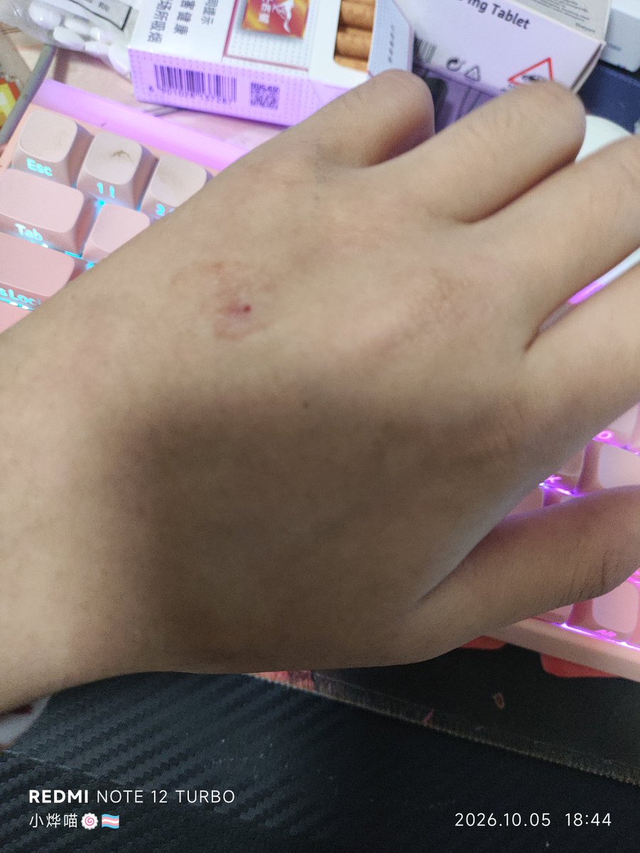 lanyemtf's tweet photo. 太疼了...
我也不忍心看到同类这么难受，咱求求妳们不可以紫砂，都给我好好活着，不管这个世界对我们做了什么也总会有美好的地方... https://t.co/BIxOiHgifM