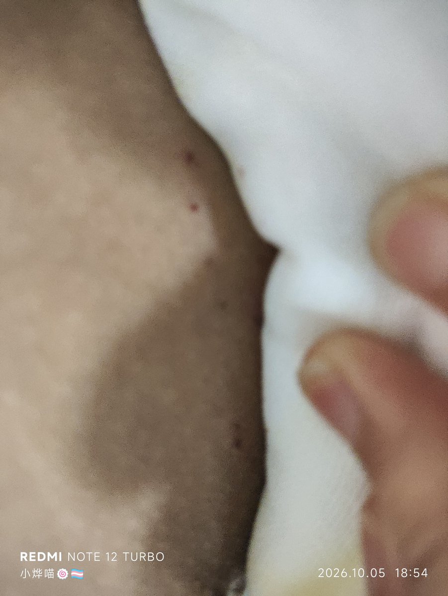 lanyemtf's tweet photo. 太疼了...
我也不忍心看到同类这么难受，咱求求妳们不可以紫砂，都给我好好活着，不管这个世界对我们做了什么也总会有美好的地方... https://t.co/BIxOiHgifM