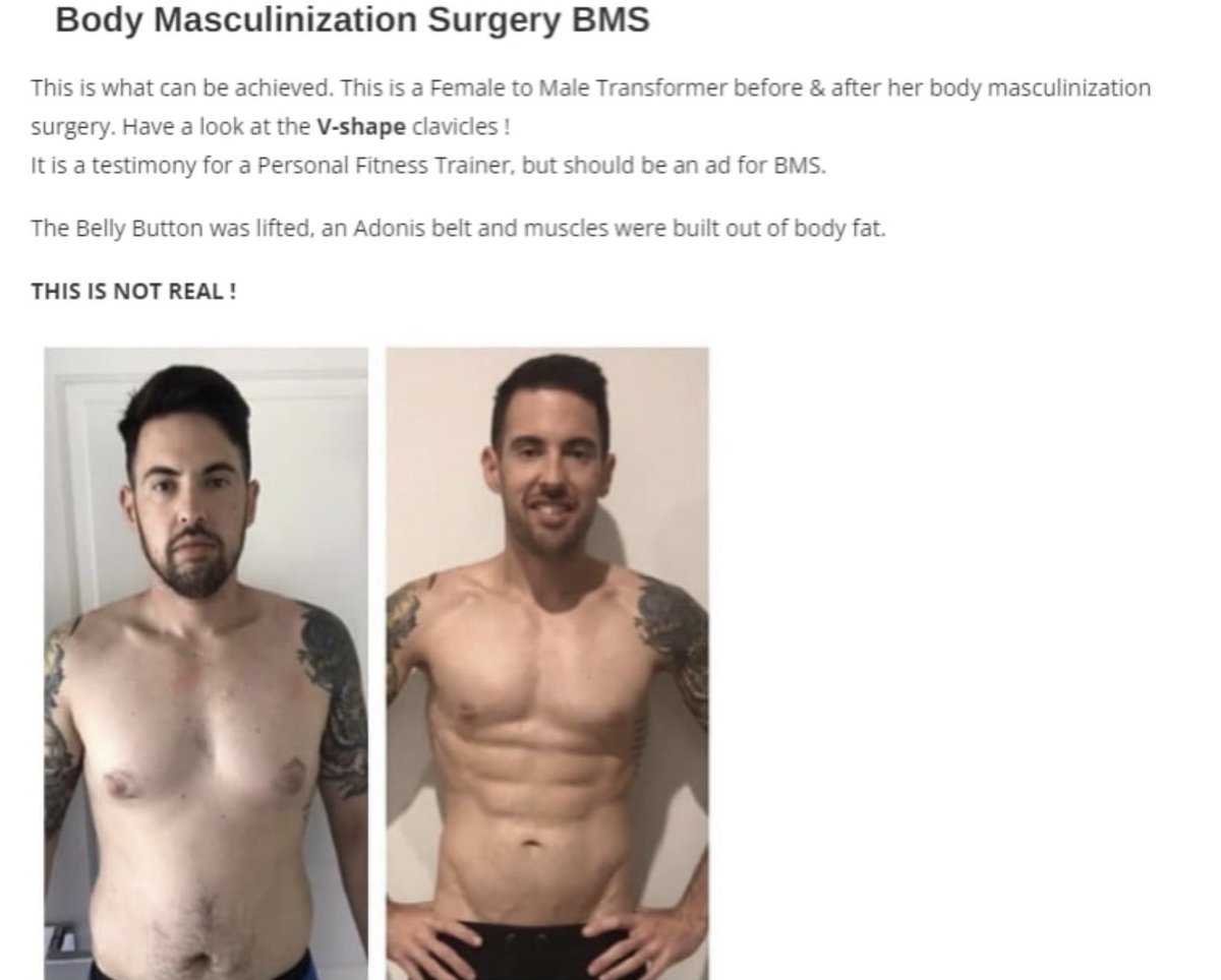 dudlooklikelady's tweet photo. @patriotwomanQ @tweedlepinkee But fat carving can. Don’t underestimate the lengths they go to fool you #ftm #transcult #sgi https://t.co/WQrbX54BRU