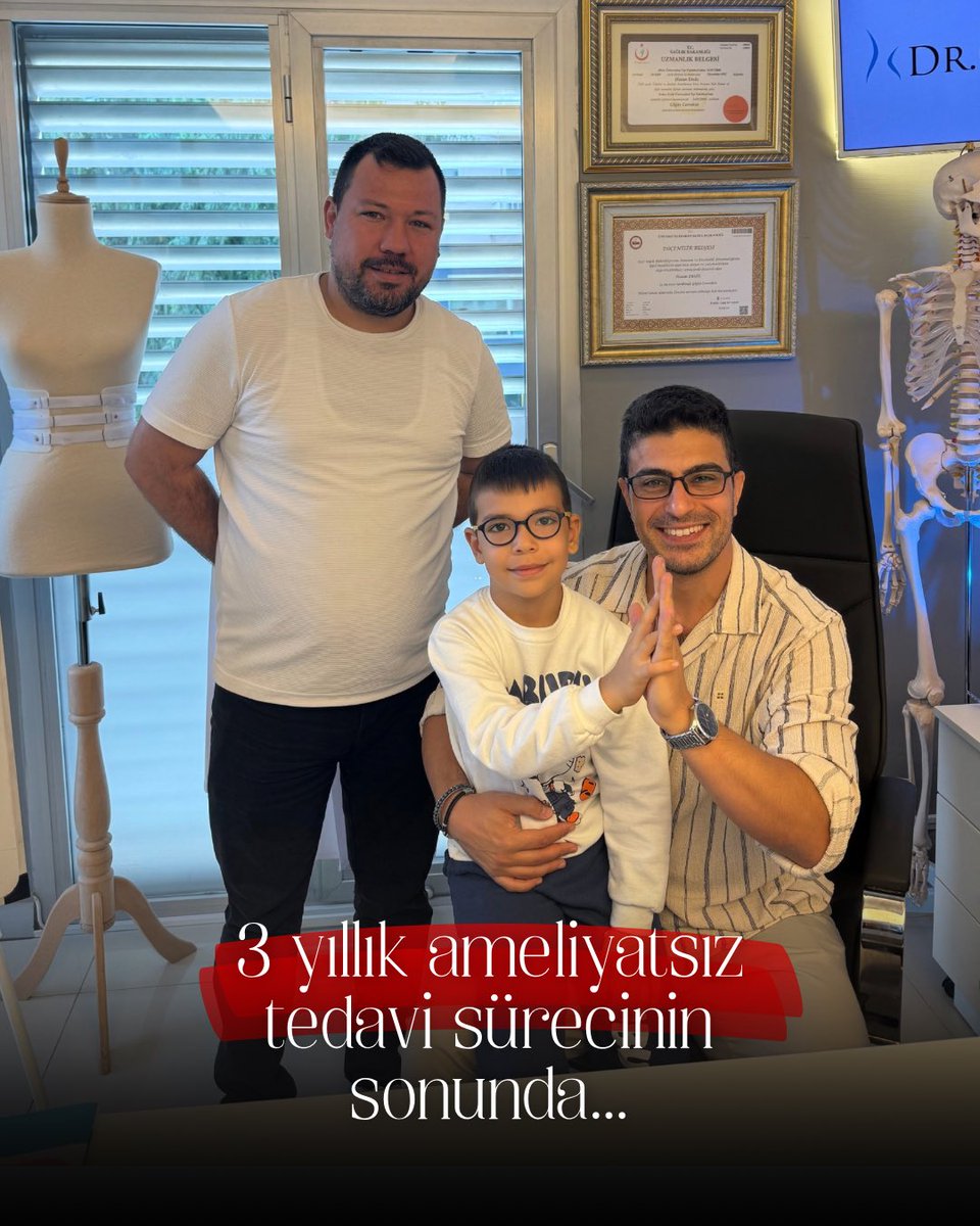 drpektus's tweet photo. ✨ At the end of a 3-year non-surgical treatment journey…

Our journey with our patient began in November 2023. At the initial evaluation, the pectus excavatum depth was measured at 1 cm, and treatment with a 9 cm vacuum bell was planned. https://t.co/50ZihHPlGS