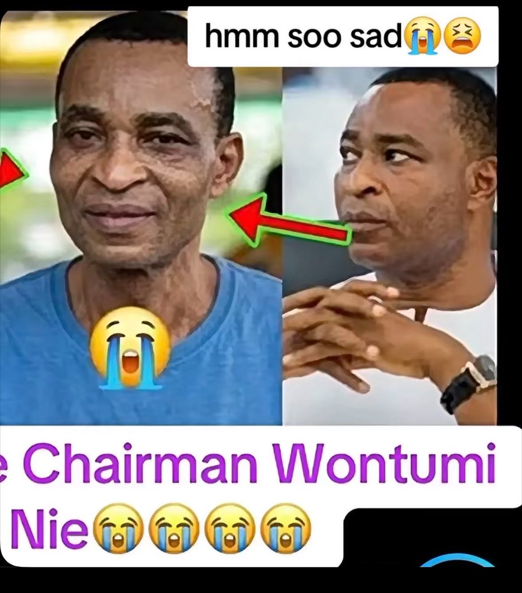 Asirifi_ofc's tweet photo. Everybody dey gi prison make fine
EReach chairman wontumi turn he turn ancestor 😭🤣 https://t.co/KYs6vi2cGn