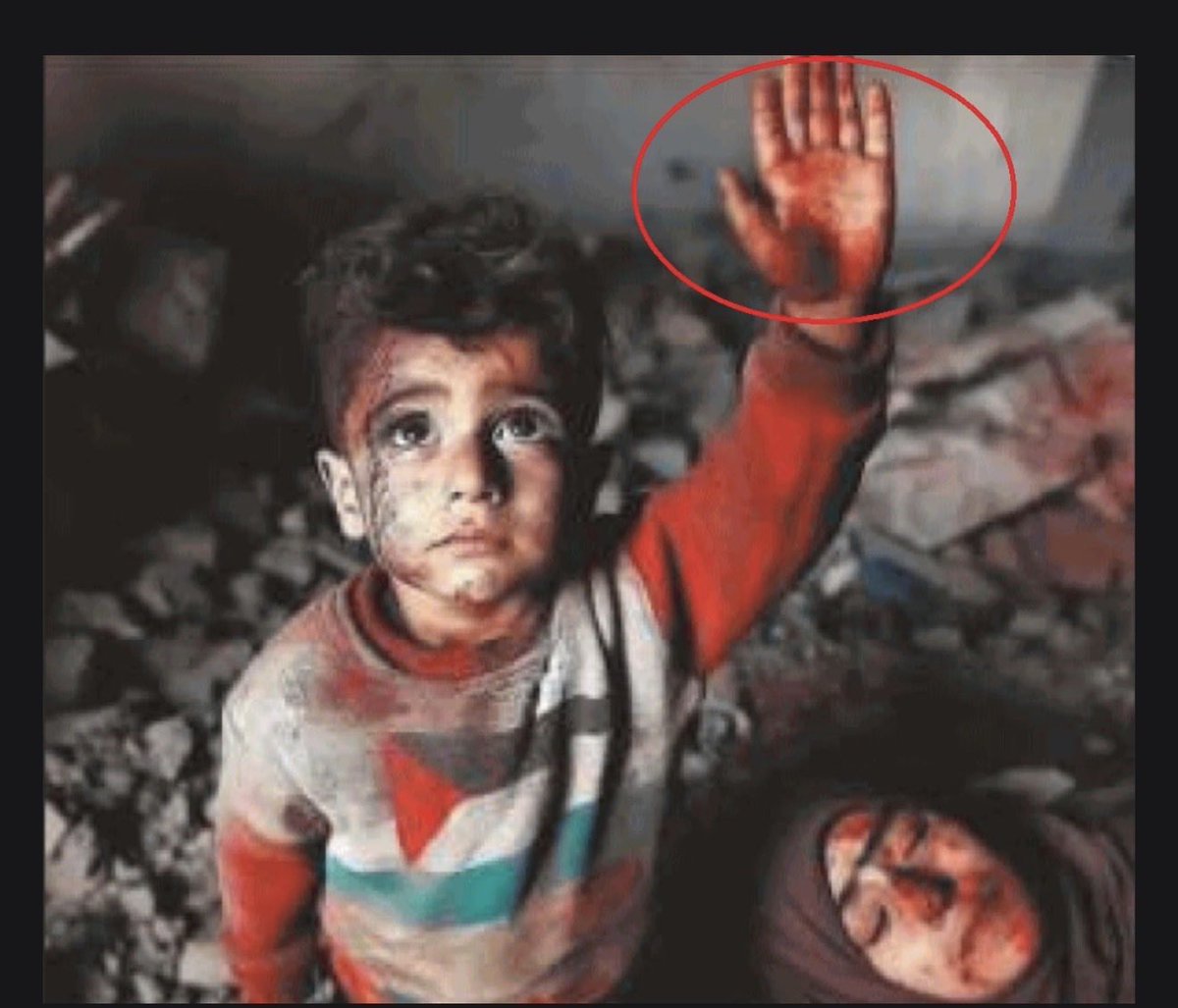 MichalSabra's tweet photo. Who can forget all the 6 fingered Palestinian children who lost their lives during the “genocide” .
Let’s hold a moment of silence for them. https://t.co/ck6sw4VMGR