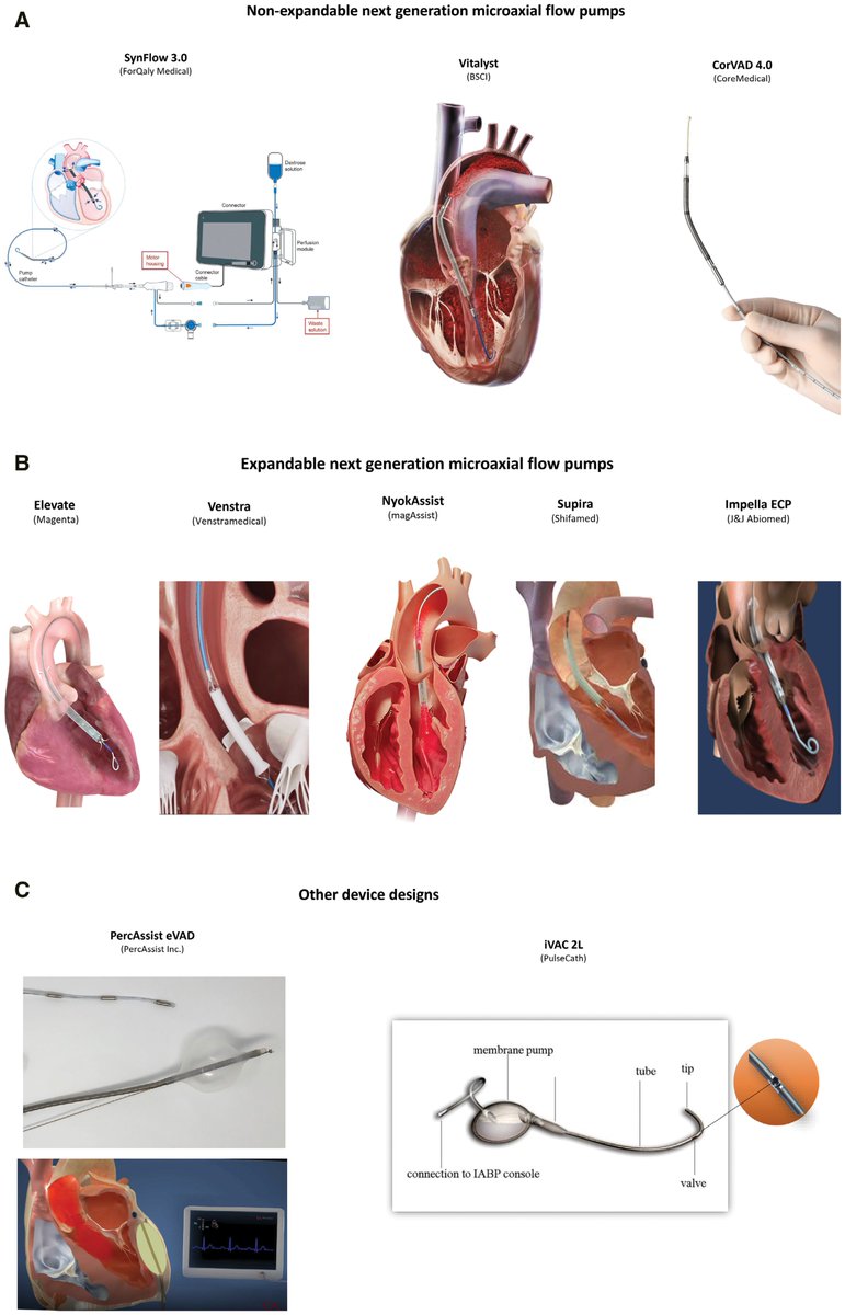 CircHF's tweet photo. Smaller access. Higher flow. Better hemocompatibility

The next generation of temporary MCS aims to improve circulatory support while reducing vascular injury and hemolysis

A look at emerging technologies reshaping support in #CardiogenicShock and high-risk PCI⚙️🫀

Read More ⬇️ https://t.co/ZF2aOpzsvP