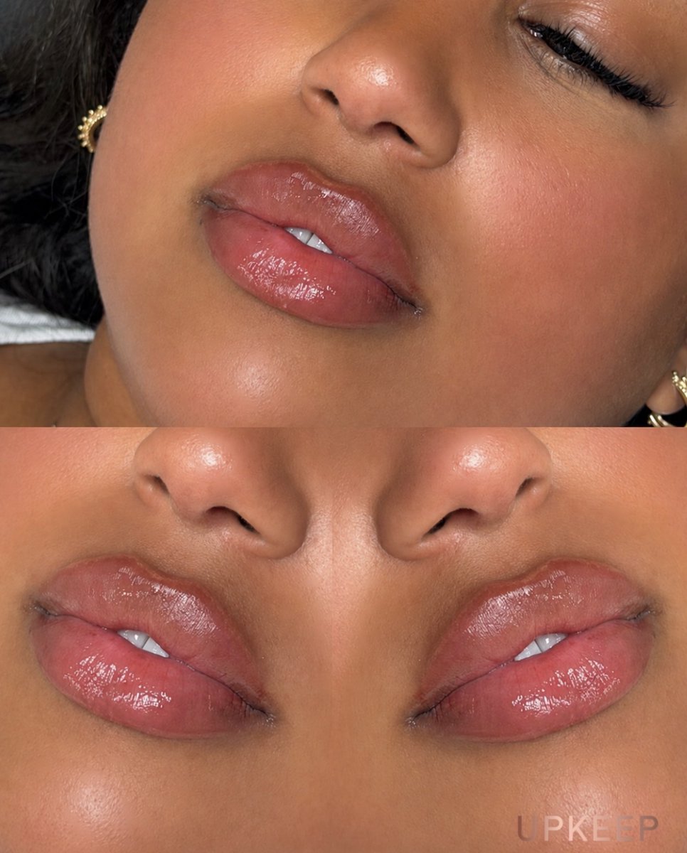 UPKEEPMEDSPA's tweet photo. Your next lip moment. 💋 

Explore full syringe lip filler at UPKEEP Med Spa with a personalized approach to your shape, fullness, and goals.

Book your lip consultation today! https://t.co/WbuBZi3qfQ

#UPKEEPMedSpa #LipFiller #LipEnhancement https://t.co/v4JrSuMCUI
