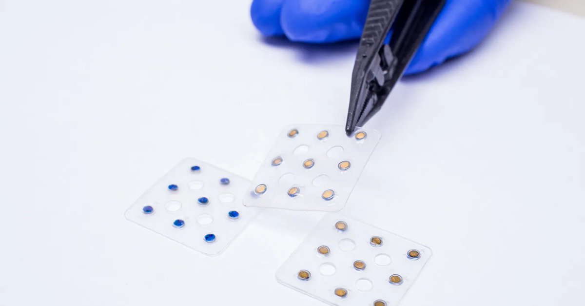 UCSDCancer's tweet photo. UC San Diego Health is the first hospital to offer a radioactive bandage for treating skin cancer. Parag Sanghvi, MD, MSPH, discusses the approach, which has also drawn coverage in Dermatology Digest and Onco Zine.

Read more: https://t.co/nrZvgaAqCa

#SkinCancer #RadiationOncology #MooresCancerCenter