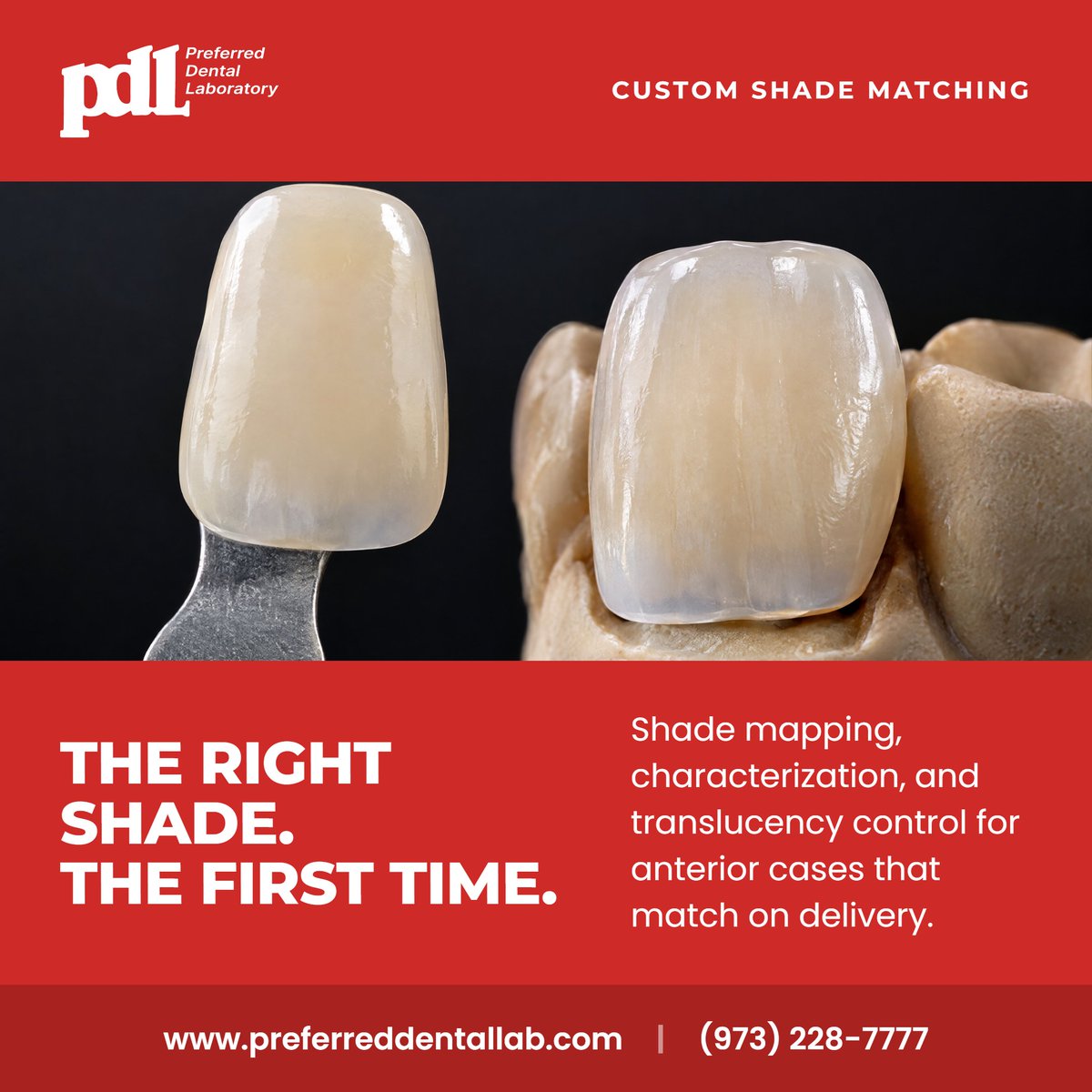 PreferredLab's tweet photo. Restorations that blend in on the first try, not the second. ✨

👉 Send your next anterior case with a shade photo https://t.co/FgcHjosdm7

#ShadeMatching #AnteriorEsthetics #DentalCeramics #EstheticRestorations #CosmeticDentistry #PreferredDentalLab #DentalLab https://t.co/6rOIalNz5A