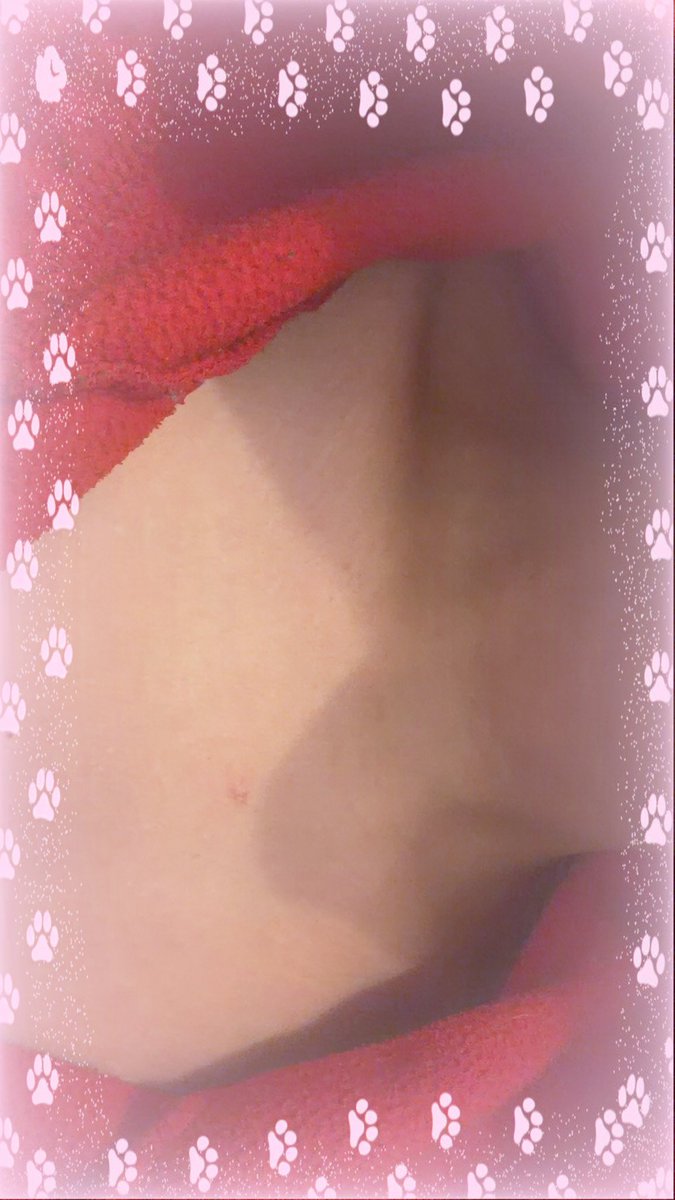 rainingac1d's tweet photo. collarbone check cuz i just got done exercising!! 

#shedrtwt #edtwt #ricecakestwt #cuttwt #slittwt #ouchietwt #988twt https://t.co/uwIrqGsf7v