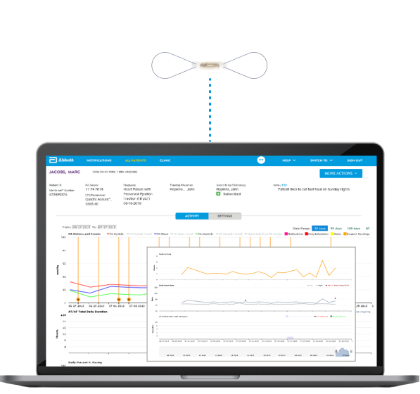 Kennedyyraye's tweet photo. Medical devices are becoming more connected to everyday care.

Abbott’s updated CardioMEMS system allows heart failure patients to view their pulmonary artery pressure trends through a smartphone app, supporting more proactive and personalized care.

#MedTech #MedicalDevices https://t.co/Bj7ABQQkdG
