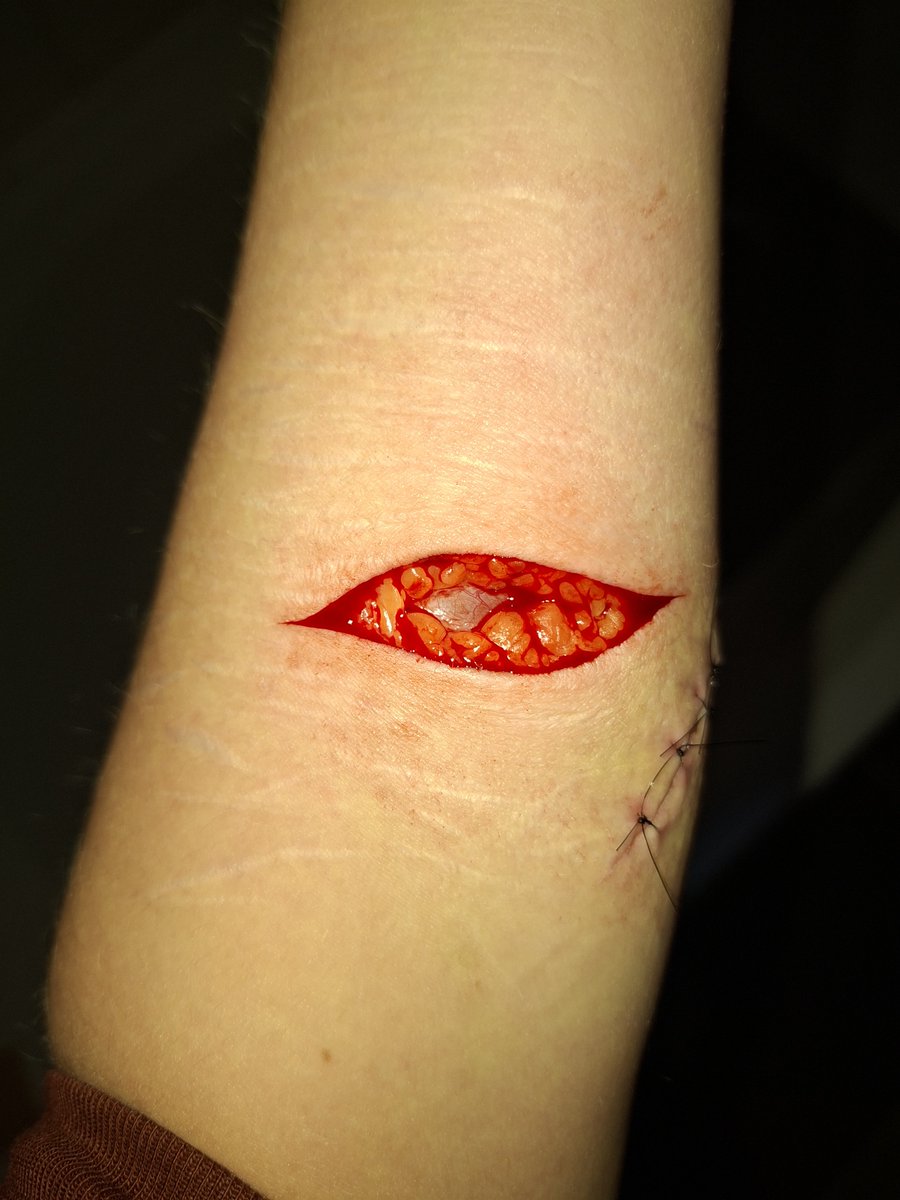 dying_ladybug's tweet photo. Fake SFX make-up! https://t.co/iQhpYm9OJ7