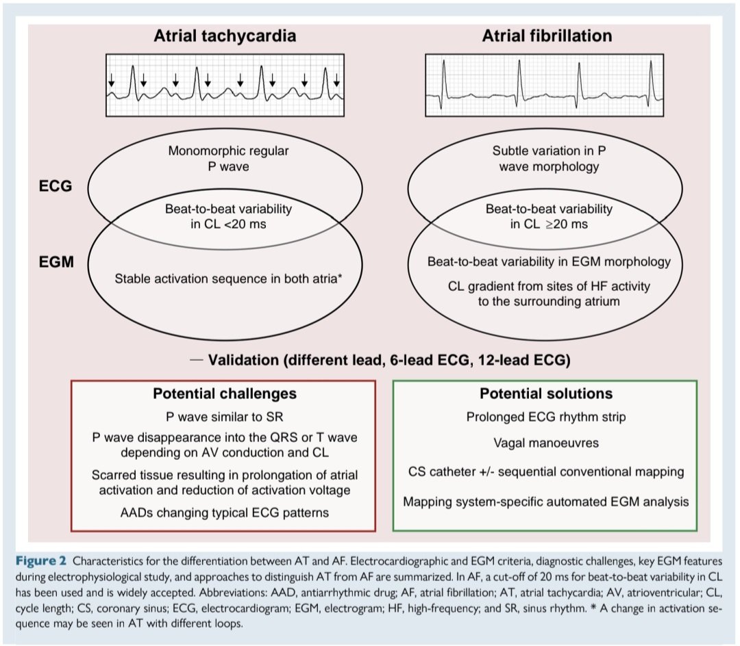javier20ch's tweet photo. Diagnóstico diferencial: Taquicardia Auricular 🆚️ Fibrilación Auricular. ⚡️🫀
👨‍⚕️💬 En algunos casos la FA puede presentarse muy “organizada” y confundirse con una TA.
🔸 TA: actividad auricular organizada, con ondas P monomórficas y regulares. La longitud de ciclo (LC) suele ser estable, con variabilidad latido a latido <20 ms.
🔸 FA "organizada": puede mostrar ondas auriculares aparentemente regulares, pero al analizar un registro prolongado aparecen variaciones sutiles en la morfología de la P y en la LC. Una variabilidad ≥20 ms favorece FA. 
⚠️ No usar únicamente V1: en FA puede observarse actividad relativamente organizada de la aurícula derecha y simular una TA. Además, si en V1 parece existir una LC “pseudorregular”, una LC auricular <200 ms es rara en TA y debe hacer pensar en FA.

https://t.co/z5pxIZQRoW