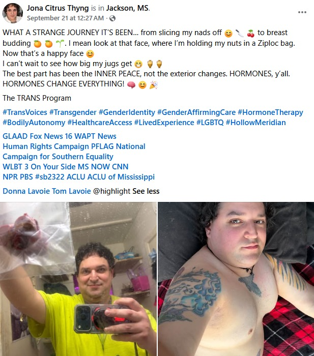 libsoftiktok's tweet photo. Man pretending to be a woman claims he chopped off his balls and holds them in a Ziploc bag

You will live to see man-made horrors beyond your comprehension. https://t.co/mN371BFd25