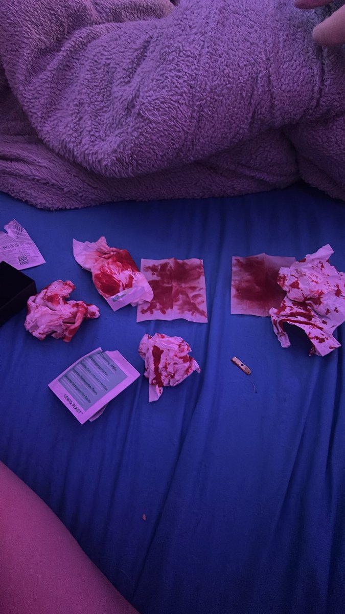 sp1ralXD's tweet photo. aftermath https://t.co/vw4xHWXuUU