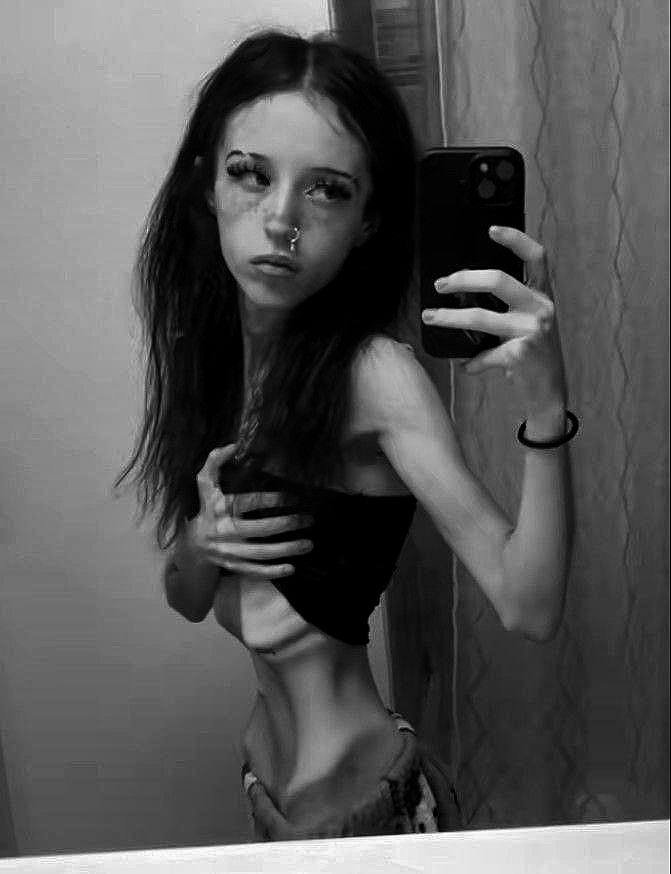 innersoulana's tweet photo. #thinspo #thinspO0 #bonespo #bonesp0 #deathspo #deathsp0 #edtwt #anablur #edtw #twana #twed #edblur #edtblur #ed #anatw #proana #edrtwt https://t.co/Usl31eyYgD
