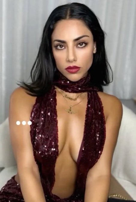 buc97552's tweet photo. Marziyeh Ebrahimi, scarred by an acid attack in Isfahan, Iran after her hijab was deemed to be improper.

The second image shows the grandniece of IRGC commander Qasem Soleimani (deceased) showing off her nice tits and living in luxury without hijab in the US https://t.co/Un5ce2Ymvw