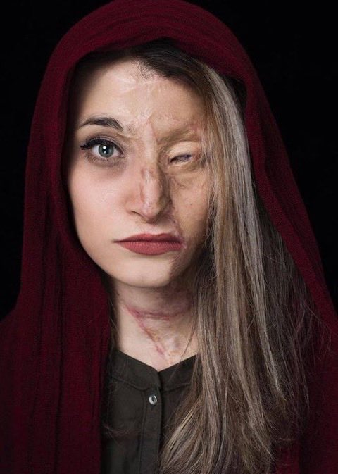 buc97552's tweet photo. Marziyeh Ebrahimi, scarred by an acid attack in Isfahan, Iran after her hijab was deemed to be improper.

The second image shows the grandniece of IRGC commander Qasem Soleimani (deceased) showing off her nice tits and living in luxury without hijab in the US https://t.co/Un5ce2Ymvw