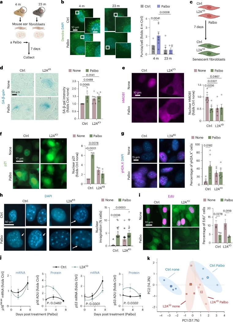agingdoc1's tweet photo. Decline of chaperone-mediated autophagy in aging impairs macrophage clearance of senescent cells

https://t.co/9UXSvhko3v https://t.co/UmKy2x6JRH