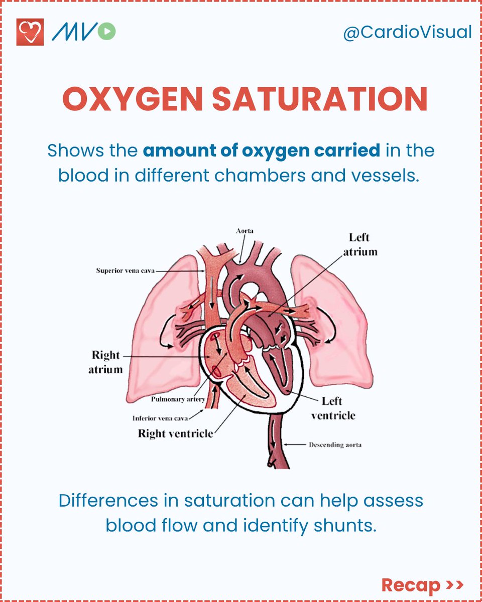 CardioVisualApp's tweet photo. What do the Cath Lab numbers actually mean? Swipe to find out!

A beginner's guide to the 5 core hemodynamic measurements: arterial pressure, PCWP, cardiac output, ventricular pressures &amp; oxygen saturation.

#Cardiology #CathLab #Hemodynamics #MedEd #MedStudent https://t.co/alIAwrbajU