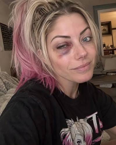 RainerSalazar3's tweet photo. @AlexaBliss_WWE His? This highly suspicious alleged accident must not be tolerated, for the sake of the example it sets. https://t.co/2rJaoWfsRr