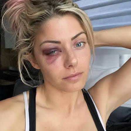 RainerSalazar3's tweet photo. @AlexaBliss_WWE His? This highly suspicious alleged accident must not be tolerated, for the sake of the example it sets. https://t.co/2rJaoWfsRr