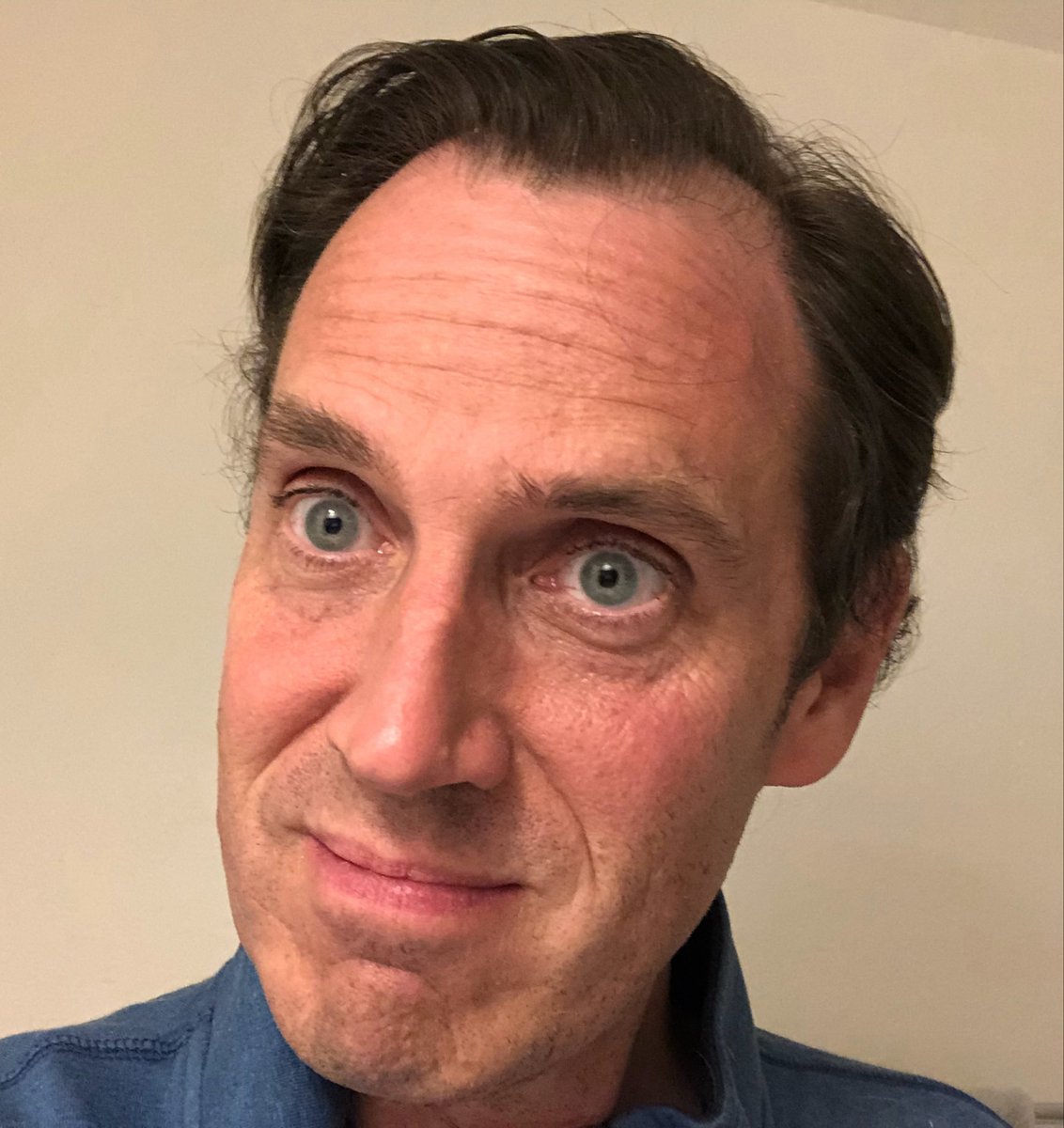 Clavuncular's tweet photo. Before &amp; After

The difference: facial muscle posture https://t.co/sskQVi7mva