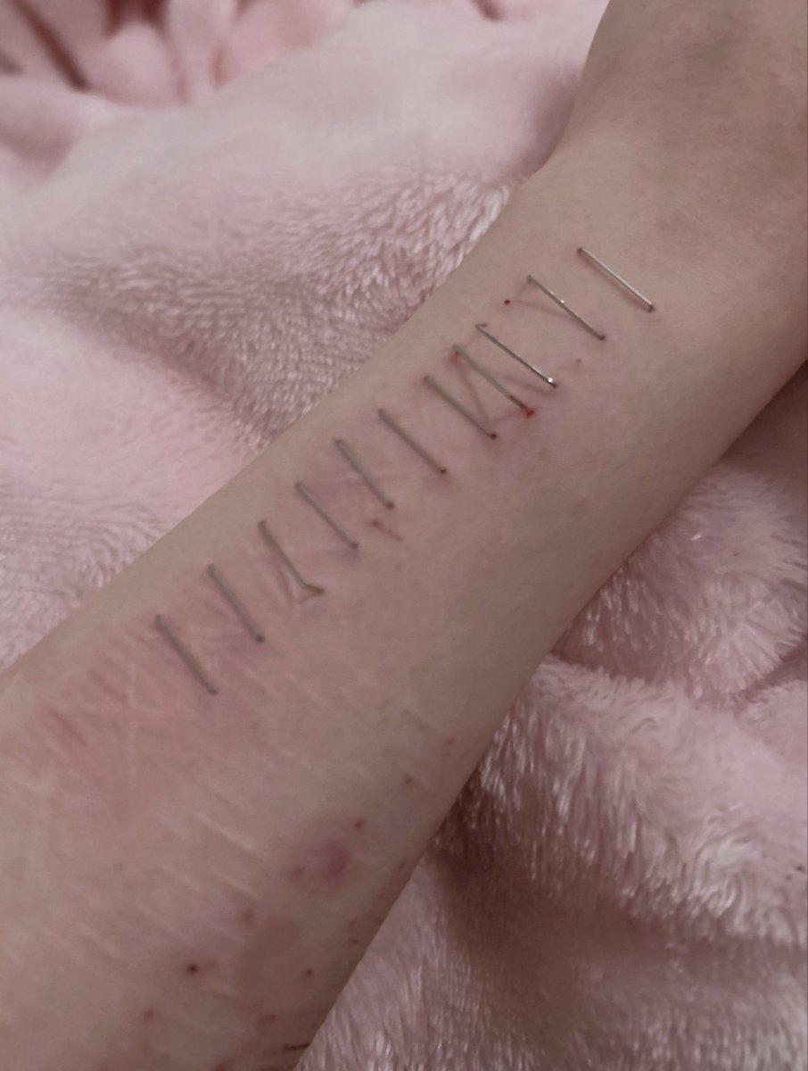 scararexic's tweet photo. ( ◠‿◠ ) (all fake SFX makeup for halloween not a real situation) ｳﾝｳﾝ https://t.co/BRPB9IWjvG