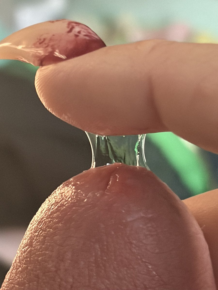 lowkeydisturbed's tweet photo. I had three fillings in my mouth 🫩 https://t.co/oxfFsrhzvX