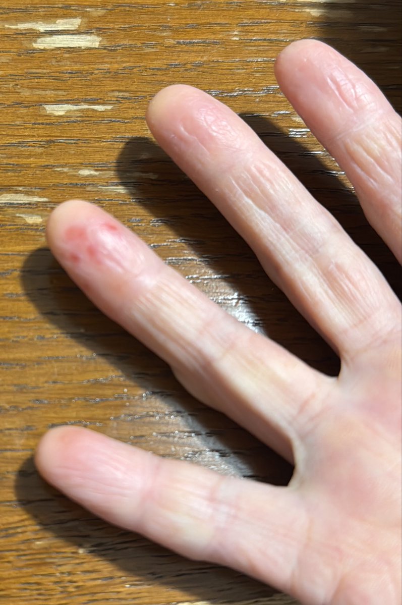 w22forever's tweet photo. 右の薬指…😭 https://t.co/NIY2UFgrVB