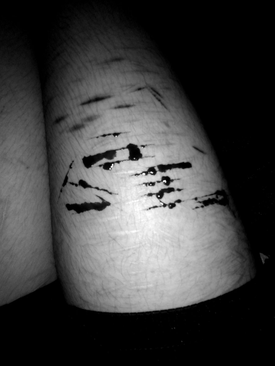 stvpidcvtter's tweet photo. SFX MAKEUP ⚠️
old cuts "sfx" #shrtwt #shedrtwt #slittwt https://t.co/trKuG8TMDo