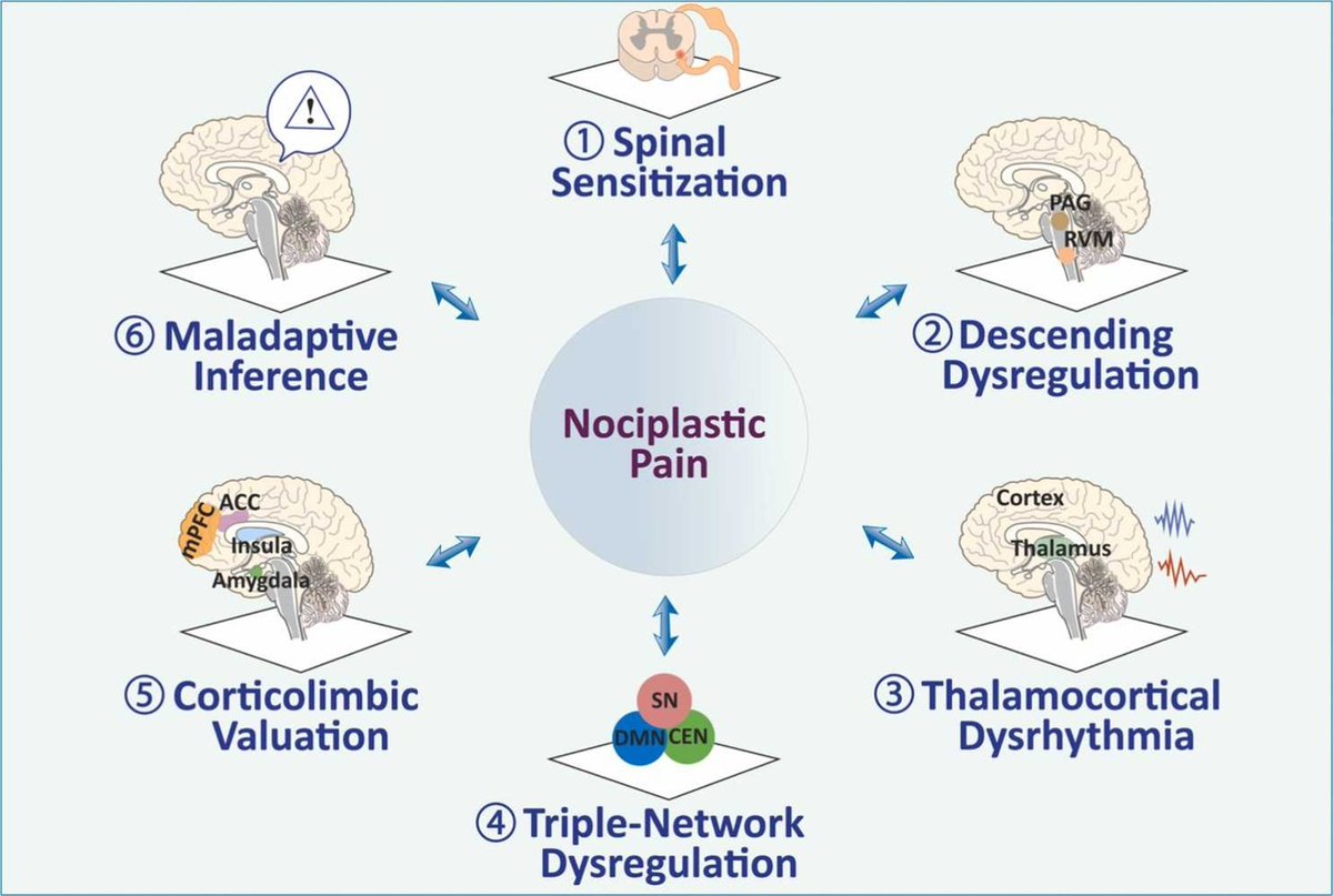 DerekGriffin86's tweet photo. Nociplastic pain
https://t.co/J8FYR0xv2c https://t.co/yhHEpJhbYP