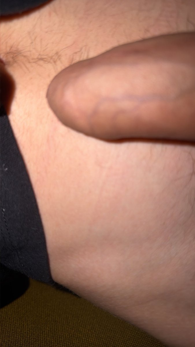 tonfrr_bb's tweet photo. Qui veut la voir 19cm ? Qui chaud la ? 
#gay #snap #nude #bite #chaud #kiffeur #bi #br https://t.co/my7WLipiyO