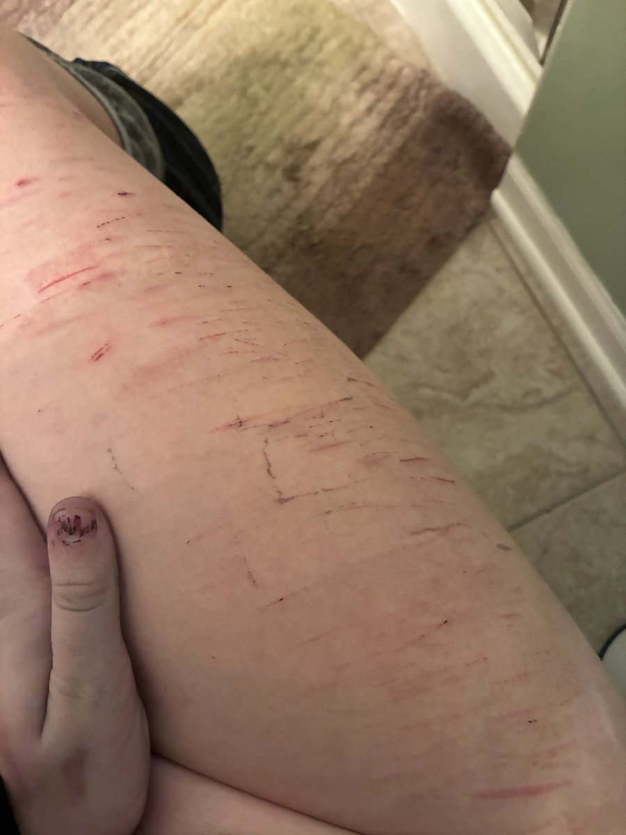 Curry29Dani's tweet photo. Scarspo?? No? Ok my fat chud will shut up. Fake sfx makeup made by ai btw.  #scarspo #shtwt #scars #sh #shrtwt #edtwt https://t.co/dHIyttmSIF