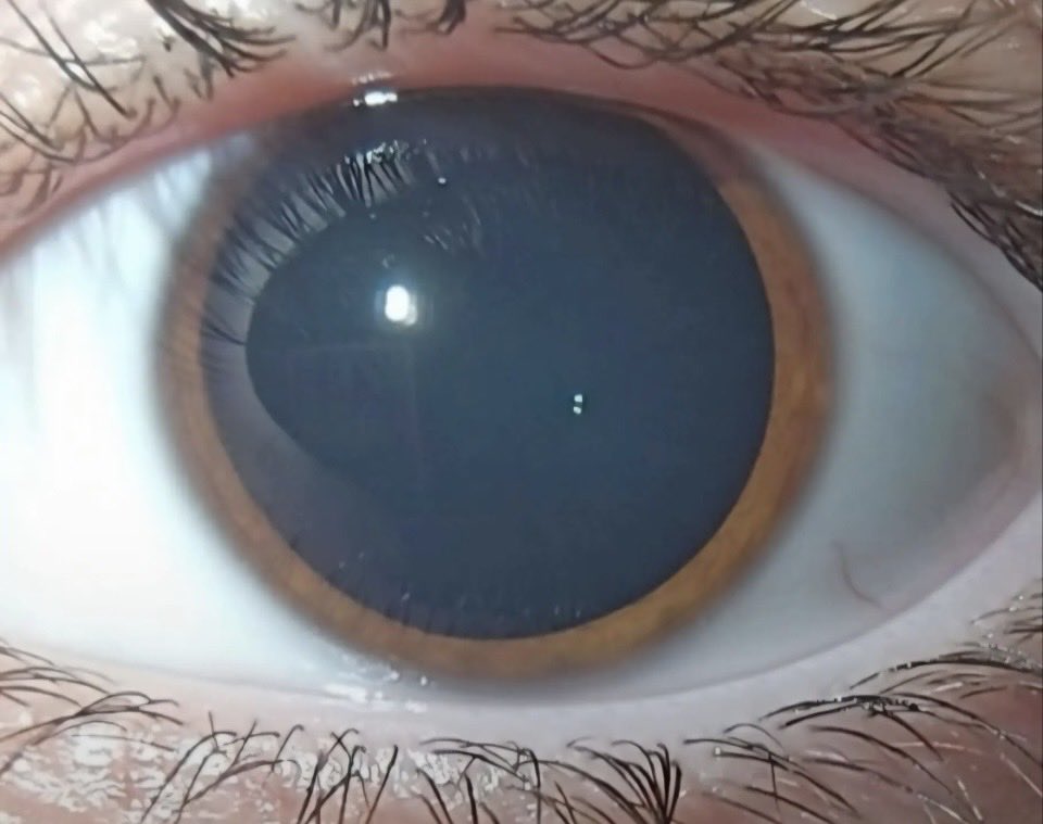 cingtroll's tweet photo. foto de sus ojos #drugstwt #subdrogs https://t.co/c49zTnOyu2